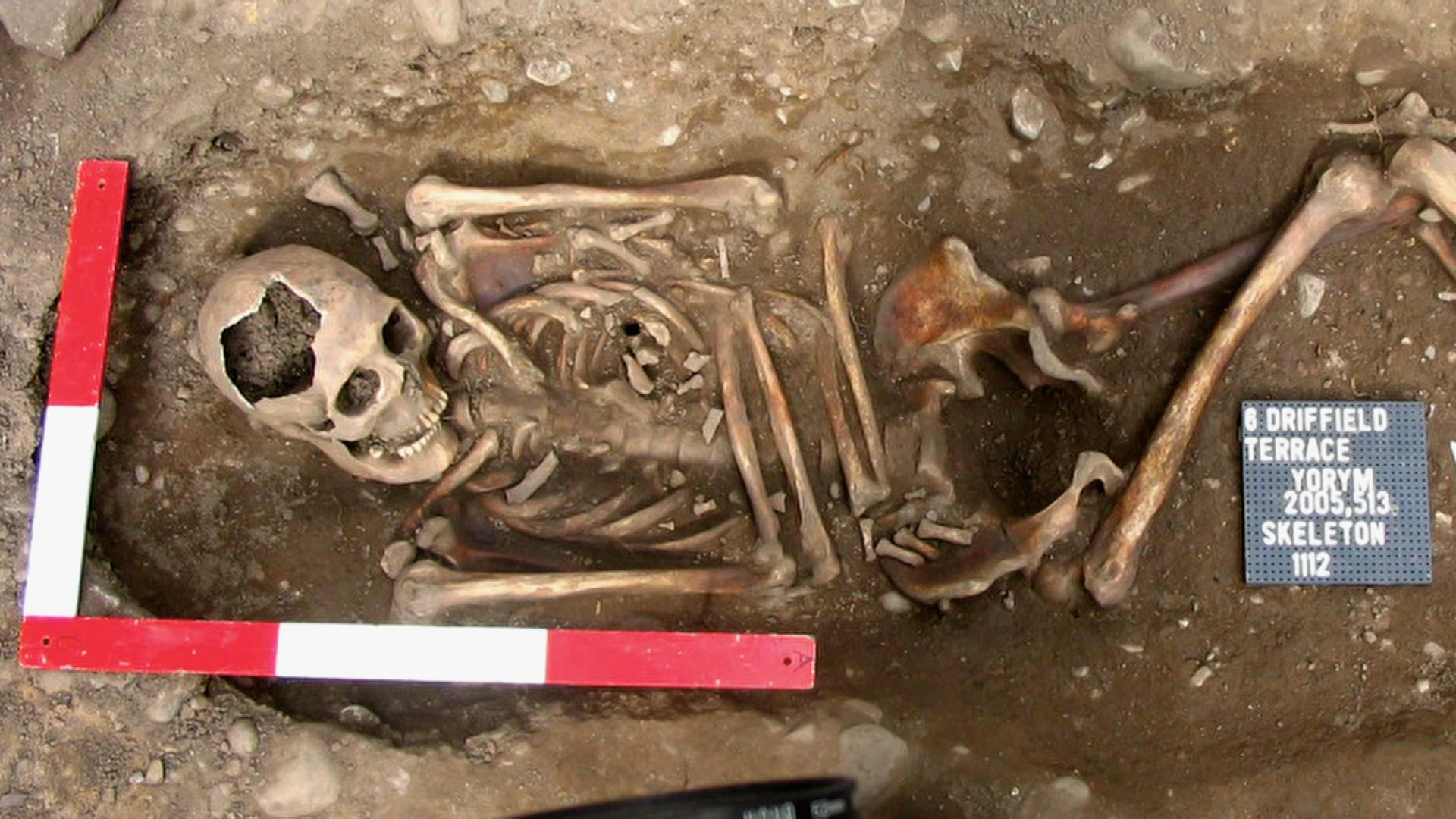 Die Skelette von York